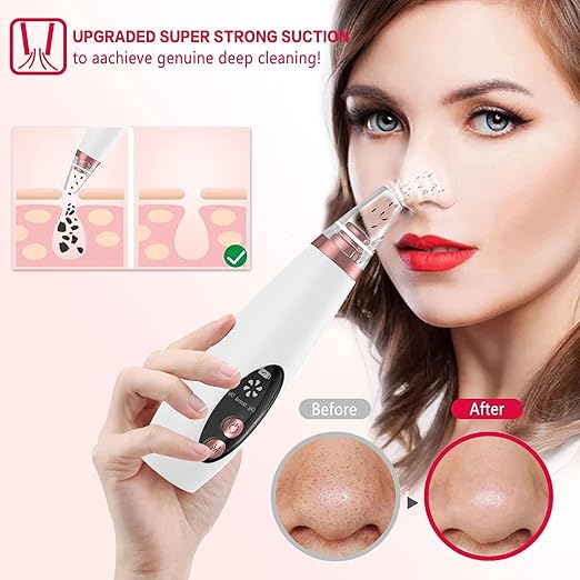 6-in-1 Facial Pore Cleanser Blackhead Remover